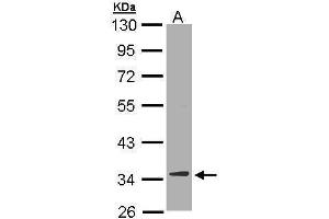 Western Blotting (WB) image for anti-2,4-Dienoyl CoA Reductase 1, Mitochondrial (DECR1) antibody (ABIN2856693)