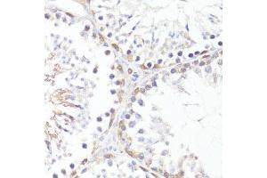 Immunohistochemistry of paraffin-embedded mouse testis using P-MYC-T58 antibody (ABIN3019538, ABIN3019539, ABIN3019540 and ABIN6225454) at dilution of 1:100 (40x lens). (c-MYC Antikörper  (pThr58))