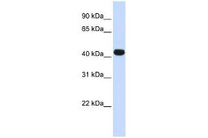 HS3ST3B1 antibody used at 1 ug/ml to detect target protein.