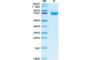 EPH Receptor B2 Protein (EPHB2) (AA 19-543) (His tag)