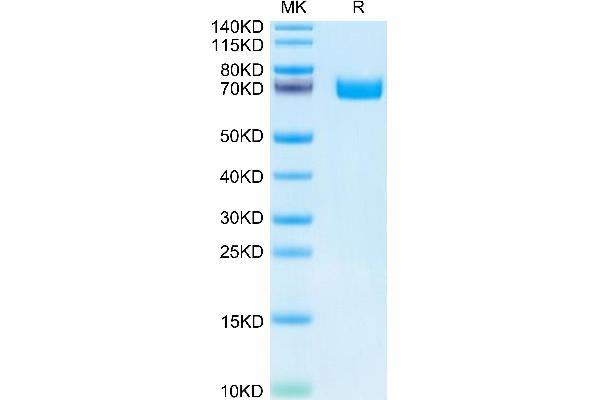 EPH Receptor B2 Protein (EPHB2) (AA 19-543) (His tag)