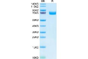 Human EPHB2 on Tris-Bis PAGE under reduced condition. (EPH Receptor B2 Protein (EPHB2) (AA 19-543) (His tag))