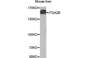 Western blot analysis of extracts of mouse liver, using ITGA2B antibody (ABIN1876881) at 1:1000 dilution. (Integrin Alpha2b Antikörper)