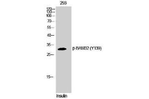 Western Blotting (WB) image for anti-Dual Adaptor of Phosphotyrosine and 3-phosphoinositides (DAPP1) (pTyr139) antibody (ABIN3179600) (DAPP1 Antikörper  (pTyr139))