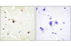Immunohistochemistry analysis of paraffin-embedded human brain tissue, using TRIM3 Antibody. (TRIM3 Antikörper  (AA 1-50))