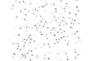 Immunocytochemistry (ICC) image for anti-Runt-Related Transcription Factor 2 (RUNX2) (AA 300-350) antibody (ABIN7795798) (Rekombinanter RUNX2 Antikörper  (AA 300-350))