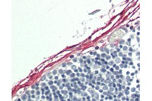 Human Fibroblasts: Formalin-Fixed, Paraffin-Embedded (FFPE). (Indian Hedgehog Antikörper  (HRP))