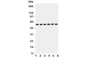 Western blot testing of AKT2 antibody and Lane 1:  HeLa;  2: PANC;  3: A549;  4: COLO320;  5: HT1080;  6: MCF-7 lysate (AKT2 Antikörper  (C-Term))