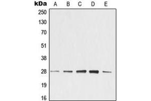 Western blot analysis of 14-3-3 zeta expression in KNRK (A), NIH3T3 (B), C4 (C), EOC20 (D), CTLL2 (E) whole cell lysates. (14-3-3 zeta Antikörper  (Center))