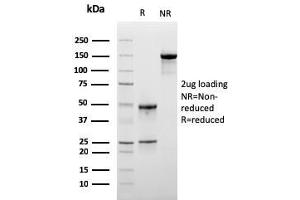 SDS-PAGE Analysis Purified Monospecific Mouse Monoclonal Antibody to LSP1 (LSP1/3025).