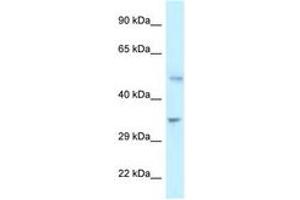 Image no. 1 for anti-6-phosphofructo-2-Kinase/fructose-2,6-Biphosphatase 1 (PFKFB1) (C-Term) antibody (ABIN6747349) (PFKFB1 Antikörper  (C-Term))