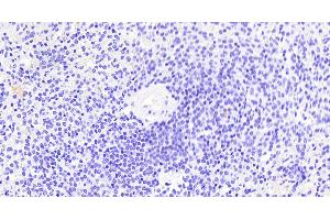 Immunohistochemistry (IHC) image for anti-Thrombospondin 1 (THBS1) (N-Term) antibody (ABIN1781811)
