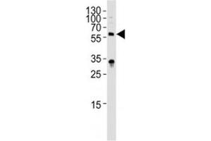 Western Blotting (WB) image for anti-Interleukin 1 Receptor, Type I (IL1R1) (AA 474-503) antibody (ABIN3031431)