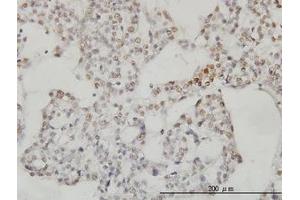 Image no. 3 for anti-Sestrin 2 (SESN2) (AA 1-481) antibody (ABIN466250) (Sestrin 2 Antikörper  (AA 1-481))