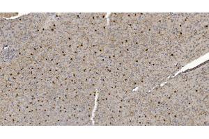 IHC analysis of Alpha B Crystallin/CRYAB using anti-Alpha B Crystallin/CRYAB antibody (ABIN7601209). (CRYAB Antikörper  (AA 30-151))