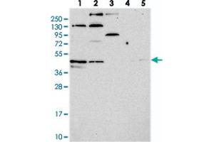 Western blot analysis of Lane 1: RT-4, Lane 2: U-251 MG, Lane 3: Human Plasma, Lane 4: Liver, Lane 5: Tonsil with C14orf80 polyclonal antibody  at 1:250-1:500 dilution. (C14ORF80 Antikörper)