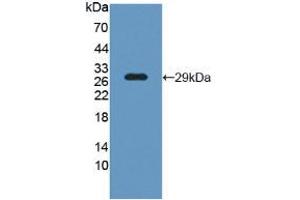 Figure. (LCP1 Antikörper  (AA 5-233))