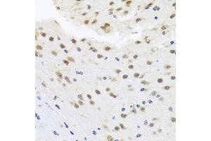 Immunohistochemistry of paraffin-embedded mouse brain using HDAC4 antibody.