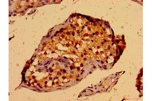 Immunohistochemistry of paraffin-embedded human testis tissue using ABIN7166440 at dilution of 1:100 (PORCN Antikörper  (AA 269-332))