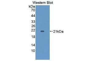 Western Blotting (WB) image for anti-Keratin 9 (KRT9) (AA 315-456) antibody (ABIN1864977) (KRT9 Antikörper  (AA 315-456))