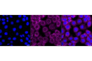 Immunocytochemical staining of HT- cells with PSMA2 antibody (ABIN7800960), 1:1,000). (Rekombinanter Proteasome 20S Subunit alpha 2 Antikörper)