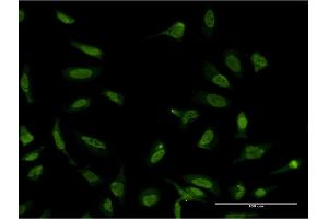 Immunofluorescence of monoclonal antibody to SFPQ on HeLa cell.