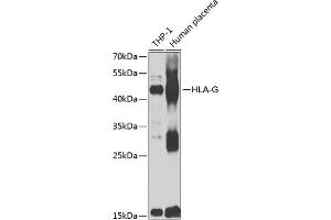 Western Blotting (WB) image for anti-HLA Class I Histocompatibility Antigen, alpha Chain G (HLAG) (AA 20-230) antibody (ABIN6141848)