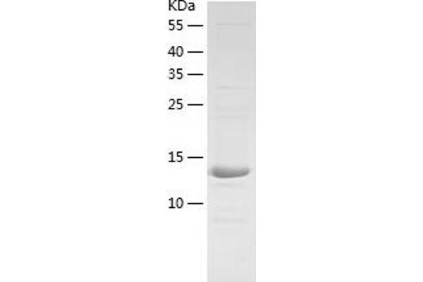 POP5 Protein (AA 1-140) (His tag)