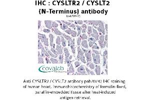 Image no. 3 for anti-Cysteinyl Leukotriene Receptor 2 (CYSLTR2) (N-Term) antibody (ABIN1733466) (CasLTR2 Antikörper  (N-Term))