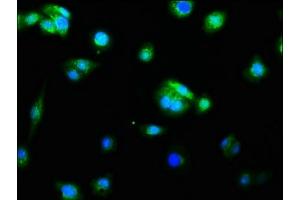 Immunofluorescence staining of HepG2 cells with ABIN7127382 at 1:60, counter-stained with DAPI. (Rekombinanter Caspase 9 Antikörper)