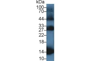 Western Blot; Sample: Rat Blood Cells lysate; Primary Ab: 1µg/ml Rabbit Anti-Equine HBb Antibody Second Ab: 0. (Hemoglobin Subunit beta Antikörper  (AA 1-147))