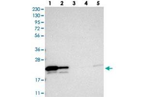 Western blot analysis of Lane 1: RT-4, Lane 2: U-251 MG, Lane 3: Human Plasma, Lane 4: Liver, Lane 5: Tonsil with GGCT polyclonal antibody .