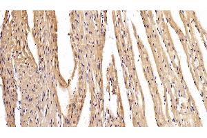 Detection of MYH2 in Mouse Cardiac Muscle Tissue using Polyclonal Antibody to Myosin Heavy Chain 2 (MYH2) (MYH2 Antikörper  (AA 1238-1472))