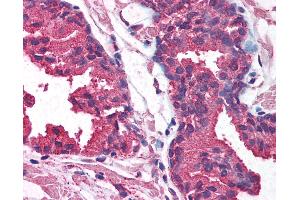Anti-AKT1 antibody IHC of human prostate.
