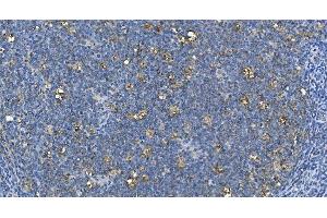 IHC analysis of Carbonic Anhydrase I/CA1 using anti-Carbonic Anhydrase I/CA1 antibody (ABIN7602620).