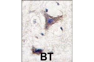 Formalin-fixed and paraffin-embedded human brain tissue reacted with SPRED1 polyclonal antibody  , which was peroxidase-conjugated to the secondary antibody, followed by DAB staining. (SPRED1 Antikörper  (C-Term))