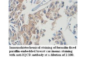 Image no. 1 for anti-IQ Motif Containing D (IQCD) antibody (ABIN1577297) (IQCD Antikörper)