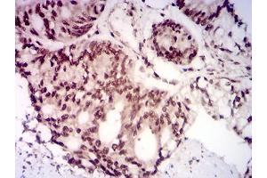 Immunohistochemistry (IHC) image for anti-AKT1 Substrate 1 (Proline-Rich) (AKT1S1) (AA 92-276) antibody (ABIN7193439)