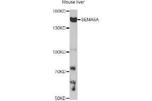 Western blot analysis of extracts of mouse liver, using SEMA5A antibody. (SEMA5A Antikörper)