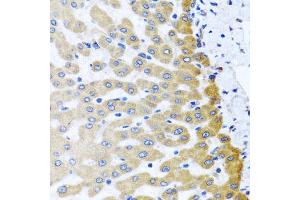 Immunohistochemistry of paraffin-embedded human liver injury using M6PR antibody (ABIN5975018) at dilution of 1/100 (40x lens).