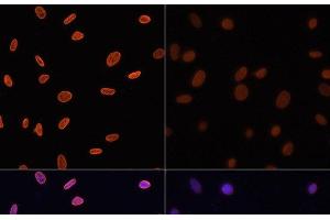 Immunofluorescence (IF) image for anti-Histone H4 (acLys12) antibody (ABIN7257734)
