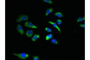 Immunofluorescent analysis of A549 cells using ABIN7170048 at dilution of 1:100 and Alexa Fluor 488-congugated AffiniPure Goat Anti-Rabbit IgG(H+L) (NKAIN4 Antikörper  (AA 83-150))