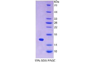 SDS-PAGE analysis of Cow IFNa Protein. (IFNA Protein)