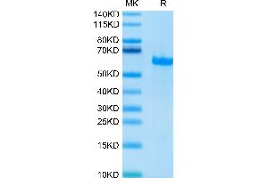 FGL1 Protein (AA 64-305) (Fc Tag)