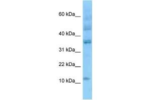 WB Suggested Anti-ID3 Antibody Titration: 1. (ID3 Antikörper  (N-Term))