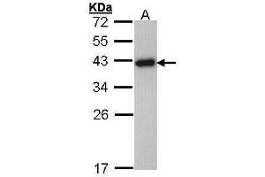 RPSA/Laminin Receptor anticorps