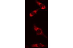 ABIN6274166 staining HeLa cells by IF/ICC. (HARS1/Jo-1 Antikörper  (C-Term))