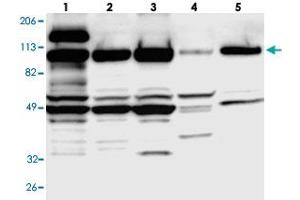 Western blot analysis of Lane 1: RT-4, Lane 2: U-251 MG, Lane 3: A-431, Lane 4: Liver, Lane 5: Tonsil with SMEK1 polyclonal antibody . (SMEK1 Antikörper)