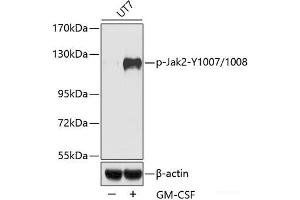 JAK2 Antikörper  (pTyr1007, pTyr1008)
