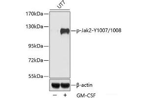 Western blot analysis of extracts of UT7 cells using Phospho-Jak2(Y1007/1008) Polyclonal Antibody. (JAK2 Antikörper  (pTyr1007, pTyr1008))